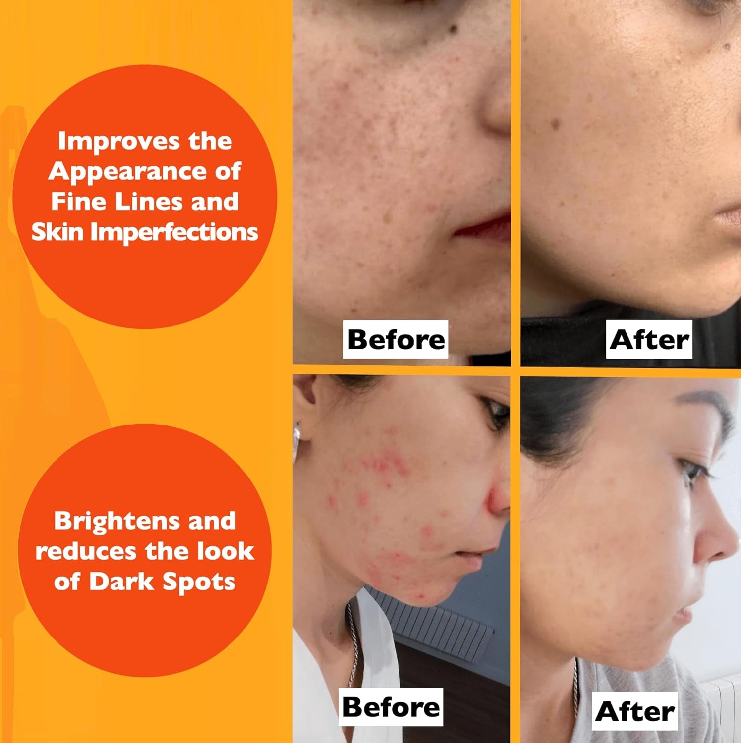 Vitamin C Serum for Face – anti Aging Face Serum with Vitamin C, Hyaluronic Acid, Vitamin E. Brightening Formula. Improve Appearance of Dark Spots, Tone, Fine Lines & Wrinkles, Glowing Skin 2 Fl Oz